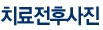 비알피부과치료전후
